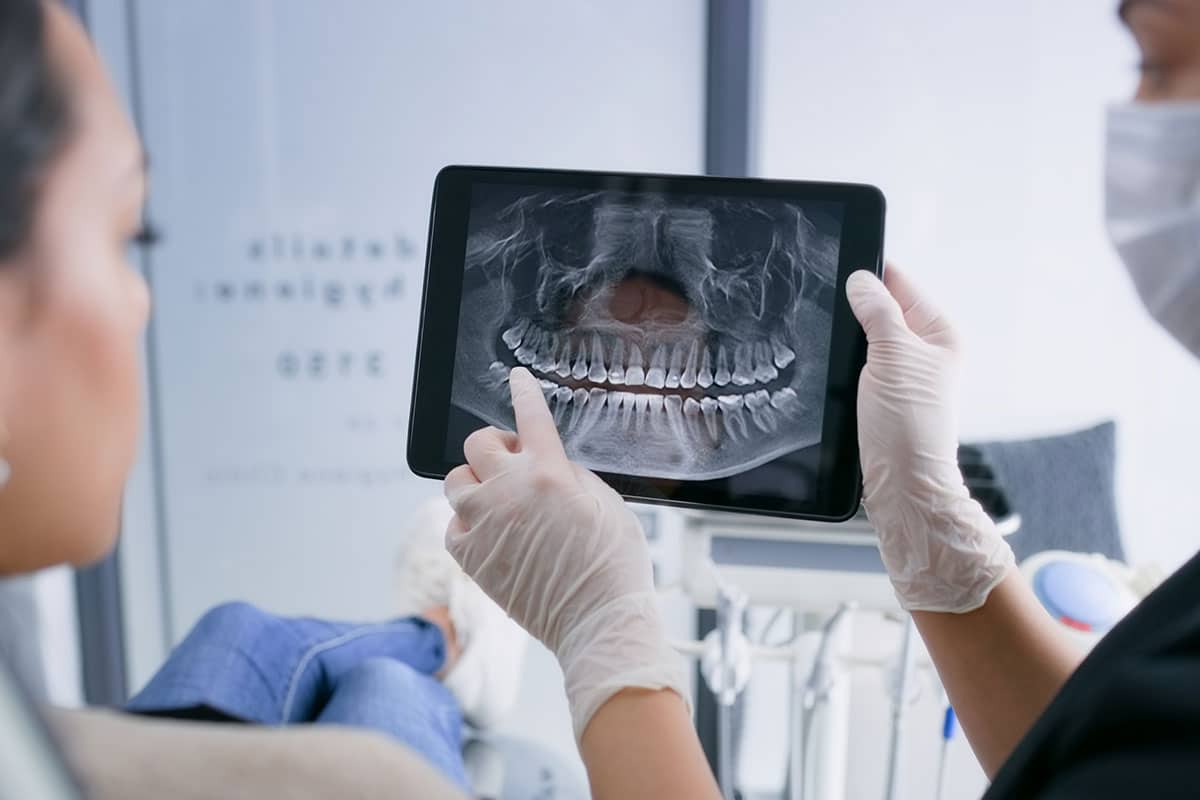 Dental X Rays What They Reveal About Your Oral Health Blog